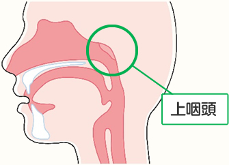 Bスポット療法（上咽頭擦過治療：EAT）